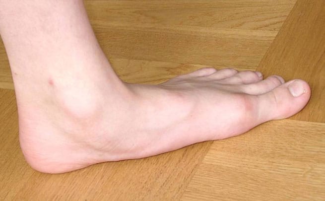 Hands, Foot & Ankle Surgery Hands, Foot & Ankle Surgery